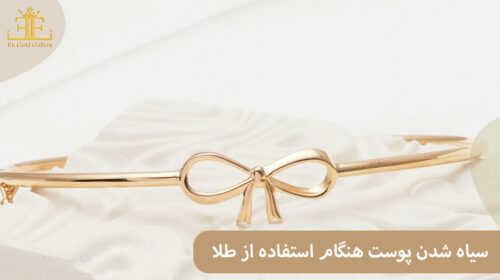 علت سیاه شدن پوست هنگام استفاده از طلا چیست و چطور از آن جلوگیری کنیم؟