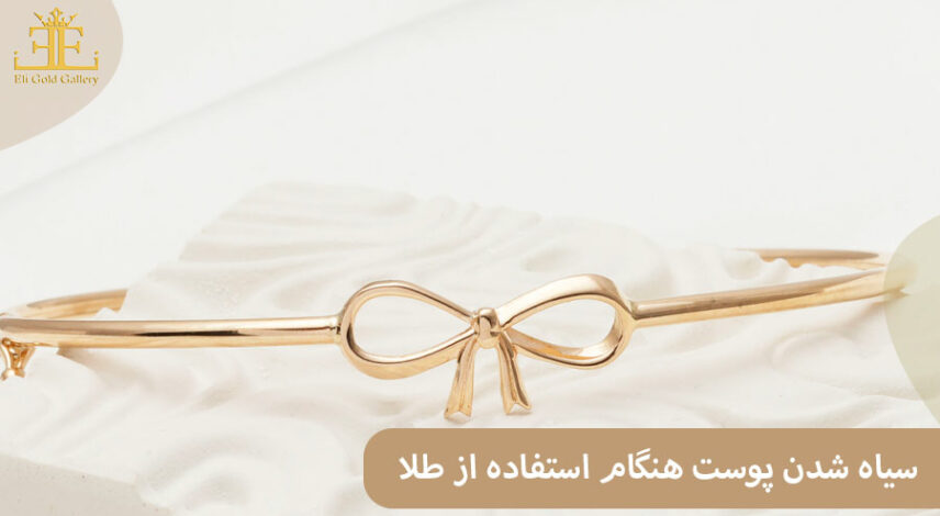 علت سیاه شدن پوست هنگام استفاده از طلا چیست و چطور از آن جلوگیری کنیم؟